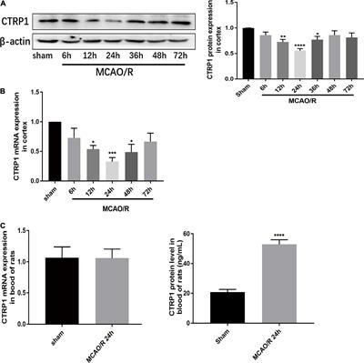 CTRP1 Attenuates Cerebral Ischemia/Reperfusion Injury via the PERK Signaling Pathway